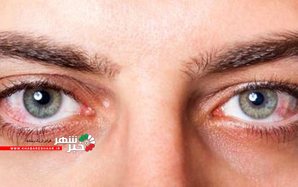 چشم Copy