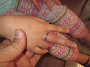 انگشتری که موجب تورم درانگشت دست دختر بچه ای شش ساله شده بود توسط آتش نشانان رهاسازی شد