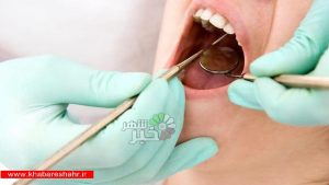 مواد پرکننده دندان چیست؟