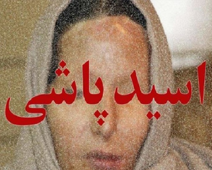اسیدپاشى در شیراز: قربانیان پدر و پسر هستند