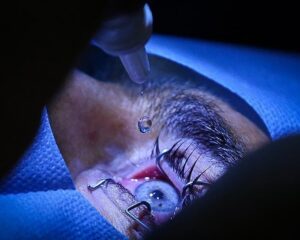 img 16112025 185336 (720 x 576 pixel)